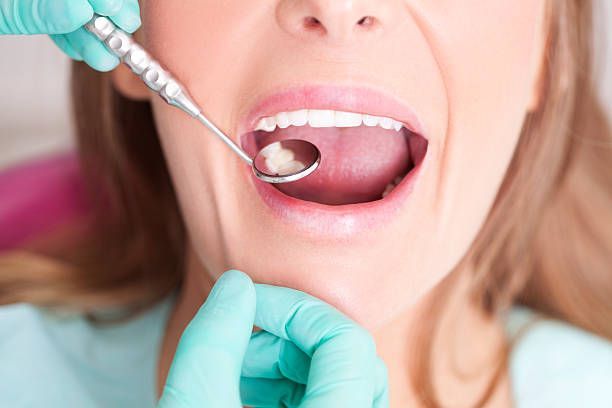 Wisdom Teeth Problems in Caldwell and Florham Park Explained