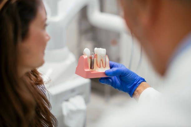 Dental Implants With Bone Grafting Procedure Explained Step By Step Clearly