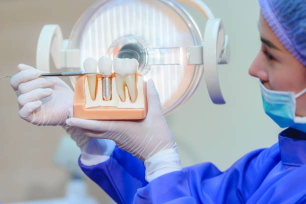All-on-4 Dental Implants in New Jersey Restore Smiles and Confidence