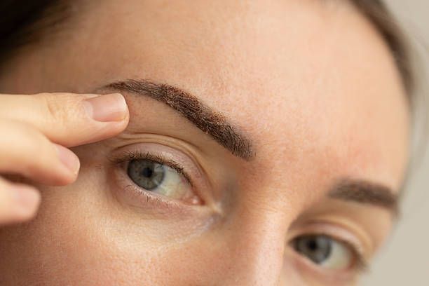 Microblading Boston with IPL Photofacial Near Boston